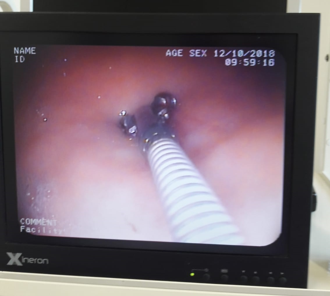 Endoscope Vetofora
